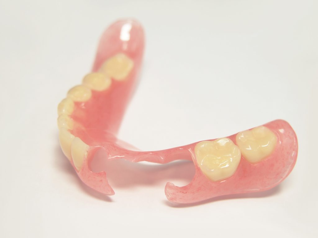 ノンクラスプデンチャーの症例写真1