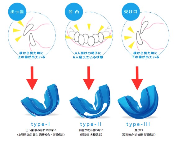 出っ歯にはタイプ１・凸凹歯にはタイプ２・受け口にはタイプ３