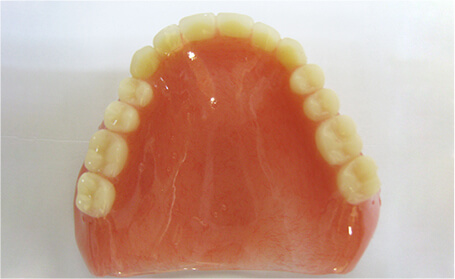 保険適用の総入れ歯