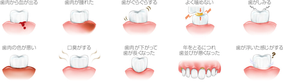 歯肉から血が出る・歯肉が腫れた・歯がぐらぐらする・よく噛めない・歯が染みる・歯肉の色が悪い・口臭がする・歯肉が下がって歯が長くなった・歳をとるにつれて歯並びが悪くなった・歯が浮いた感じがする