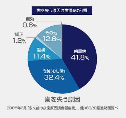 歯を失う原因第一位は歯周病です