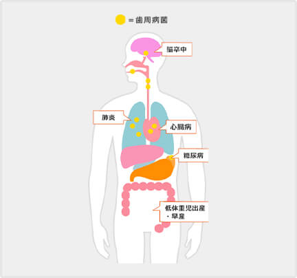 脳卒中、肺炎、心臓病、糖尿病、低体重児出産、早産