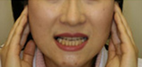前に突き出す