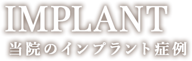 Implant 当院のインプラント症例